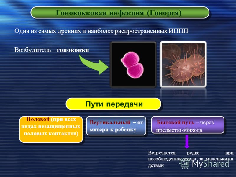 Опасность ЗППП и методы их диагностики