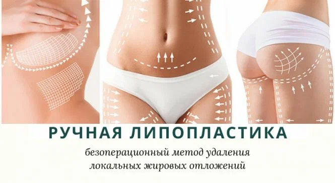 Ручная липопластика: как тонкая работа рук возвращает гармонию силуэту